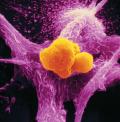 Il freddo accelera la crescita delle cellule tumorali?